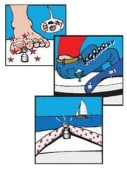 Perfix tente çıtçıtı